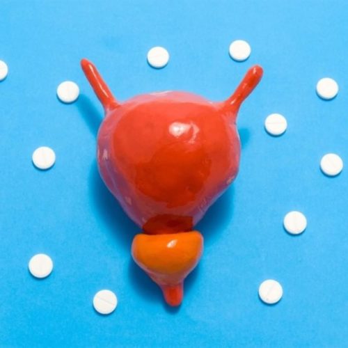 عملية البروستاتا بالليزر