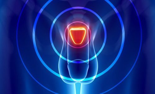 Aerzte-medizinische-Zentren-Prostatakrebs_pF3Cudc.jpg.730x0_q85_crop_upscale عملية البروستاتا